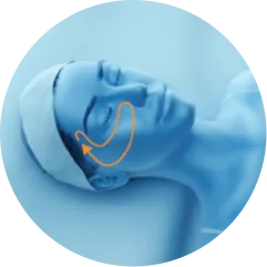 3D head diagram showing the upper cheeks for EMface facial toning in Amsterdam