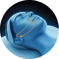3D head diagram showing the lower cheeks for EMface facial toning in Amsterdam
