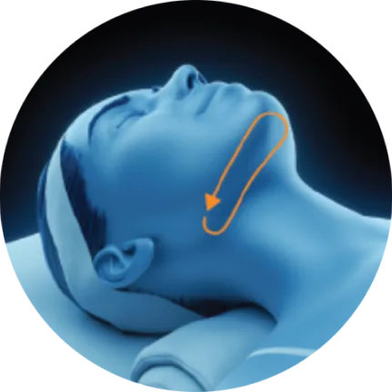 3D head diagram showing the area under the chin for EMface facial toning in Amsterdam